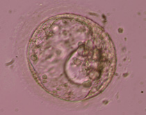 Expanded blastocyst 4CC